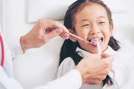 Topical Fluoride (Imunisasi Gigi)